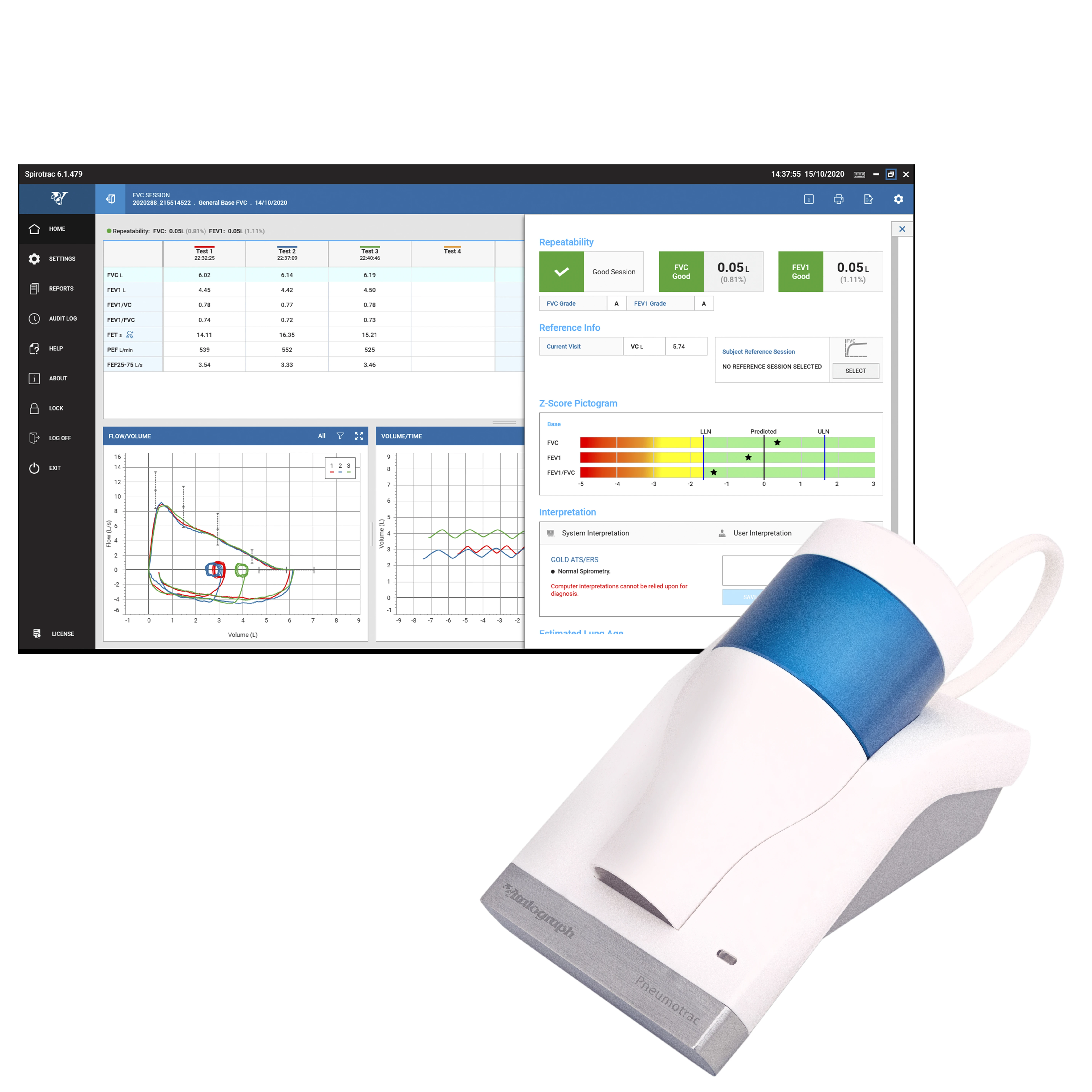 Vitalograph  Pneumotrac™  PC-Spirometer